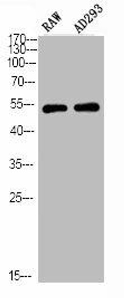 Phospho-PTEN (S380/T382/T383) Antibody (PACO03034)