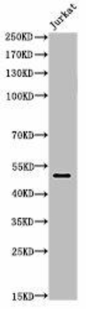 Acetyl-FOXA1 (K264/253/211) Antibody (PACO06058)
