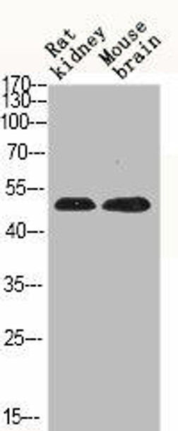 Phospho-MAPK8/MAPK9/MAPK10 (T183) Antibody (PACO06137)