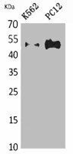 TUBA1A/TUBA1B/TUBA1C/TUBA3C/TUBA4A Antibody (PACO06879)