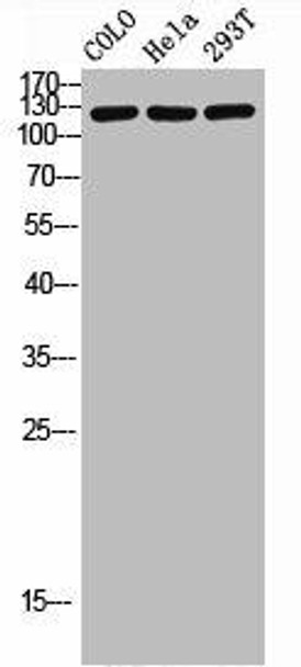 Phospho-HDAC5/HDAC9 (S259/220) Antibody (PACO06931)