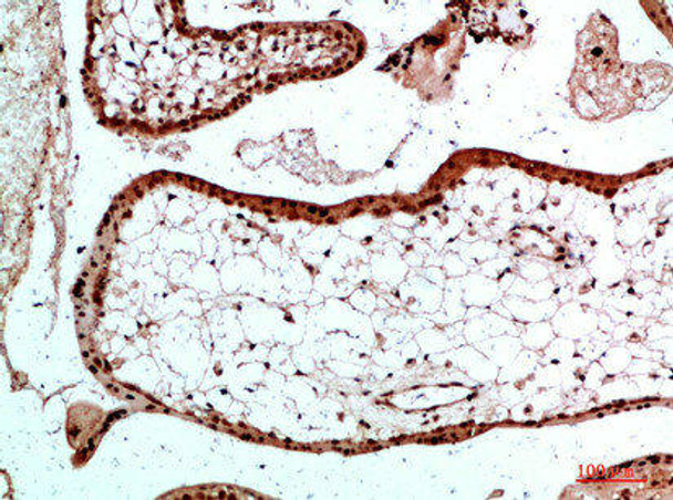 UBB/UBC/RPS27A/UBA52 Antibody (PACO07395)