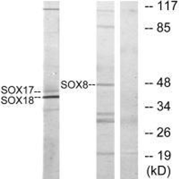 SOX8/SOX9/SOX17/SOX18 Antibody (PACO23234)