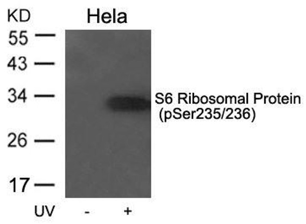 Phospho-RPS6 (Ser235/236) Antibody (PACO23913)