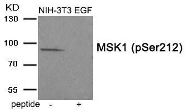 Phospho-RPS6KA5 (Ser212) Antibody (PACO24025)