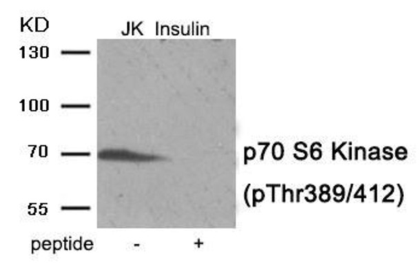 Phospho-RPS6KB1 (Thr389/412) Antibody (PACO24060)