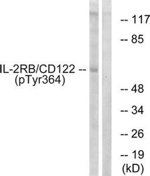 Phospho-IL2RB (Tyr364) Antibody (PACO24096)