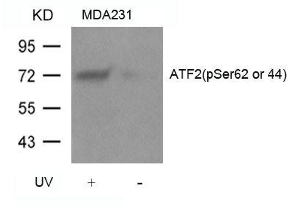 Phospho-ATF2 (Ser62 or 44) Antibody (PACO24230)