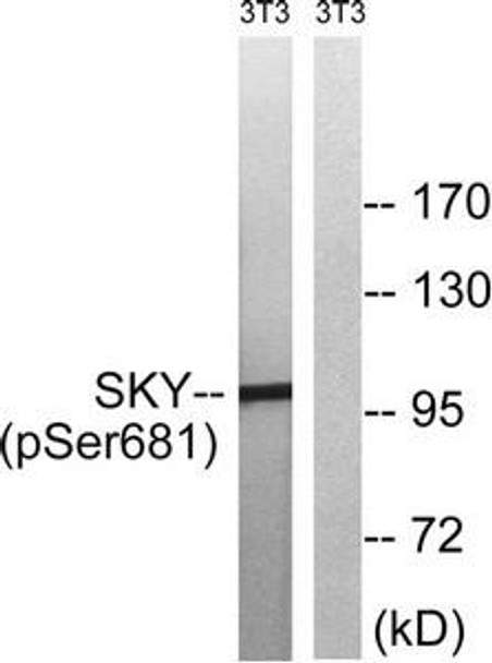 Phospho-MERTK/TYRO3 (Tyr749/681) Antibody (PACO24391)