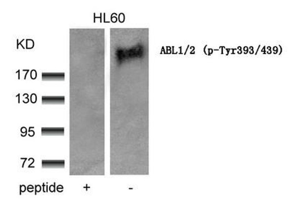 Phospho-ABL1/ABL2 (Tyr393/439) Antibody (PACO24508)