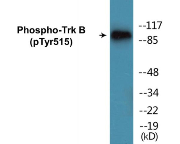Trk B (Phospho-Tyr515) Colorimetric Cell-Based ELISA Kit
