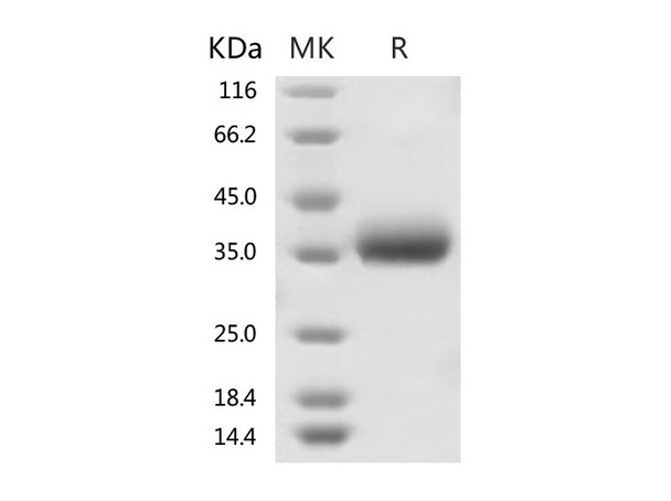 2019-nCoV Spike Recombinant Protein (RPES0065)