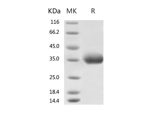 2019-nCoV Spike Recombinant Protein (K458R) (RPES0070)