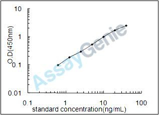 Human Ferritin, mitochondrial (FTMT) ELISA Kit (HUEB1370)