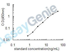 Human Homeobox protein OTX2 (OTX2) ELISA Kit (HUEB1537)