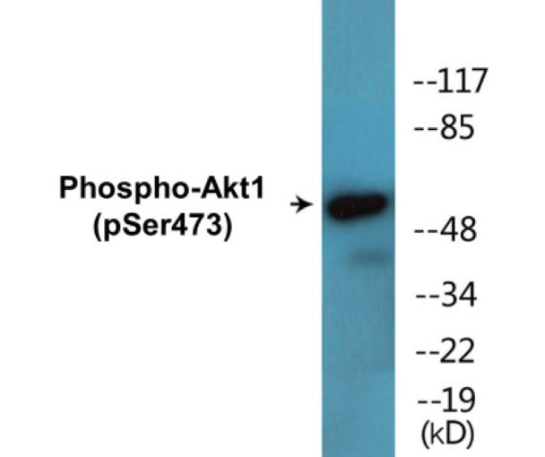 Akt1 (Phospho-Ser473)Colorimetric Cell-Based ELISA Kit (CBCAB00019)