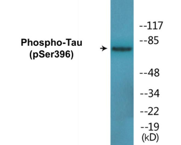 Tau (Phospho-Ser396)Colorimetric Cell-Based ELISA Kit (CBCAB00038)