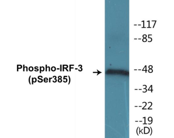 IRF-3 (Phospho-Ser385)Colorimetric Cell-Based ELISA Kit (CBCAB00043)