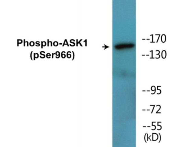 ASK1 (Phospho-Ser966)Colorimetric Cell-Based ELISA Kit (CBCAB00049)