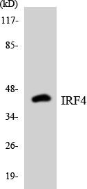 IRF4 Colorimetric Cell-Based ELISA (CBCAB00068)