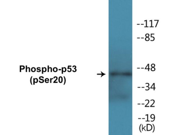 p53 (Phospho-Ser20)Colorimetric Cell-Based ELISA Kit (CBCAB00097)