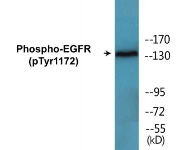 EGFR (Phospho-Tyr1172)Colorimetric Cell-Based ELISA Kit (CBCAB00104)