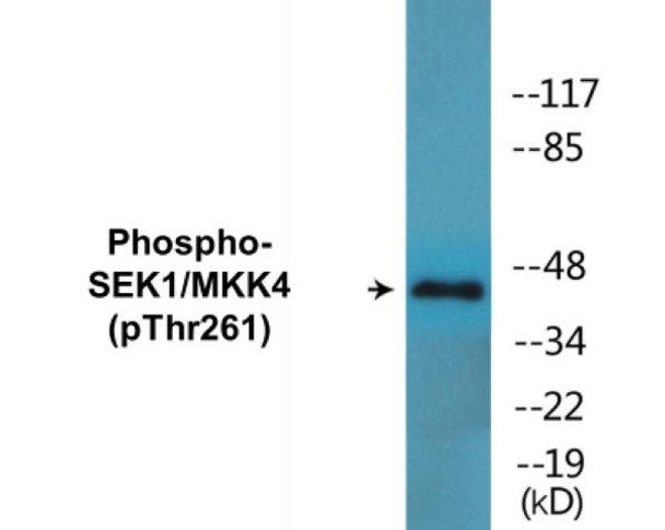 SEK1/MKK4 (Phospho-Thr261)Colorimetric Cell-Based ELISA Kit (CBCAB00107)