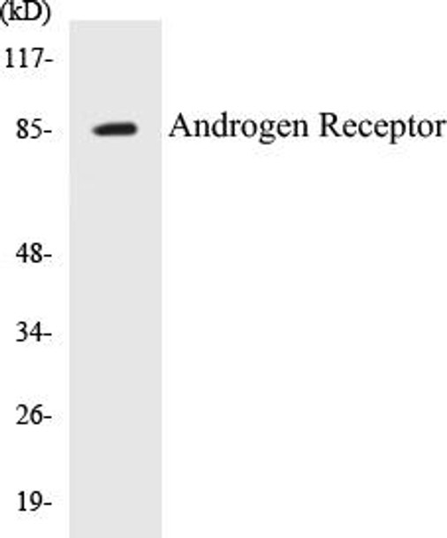 Androgen Receptor Colorimetric Cell-Based ELISA Kit (CBCAB00111)