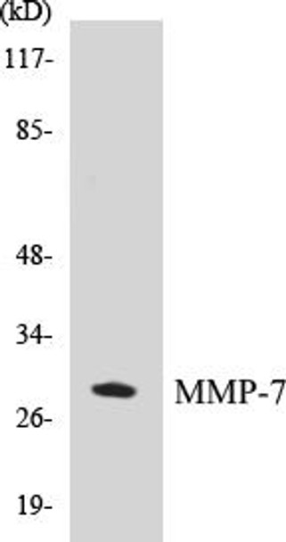 MMP-7 Colorimetric Cell-Based ELISA Kit (CBCAB00129)