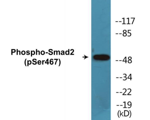 Smad2 (Phospho-Ser467)Colorimetric Cell-Based ELISA Kit (CBCAB00136)