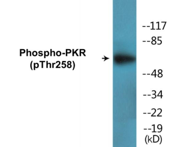 PKR (Phospho-Thr258)Colorimetric Cell-Based ELISA Kit (CBCAB00150)