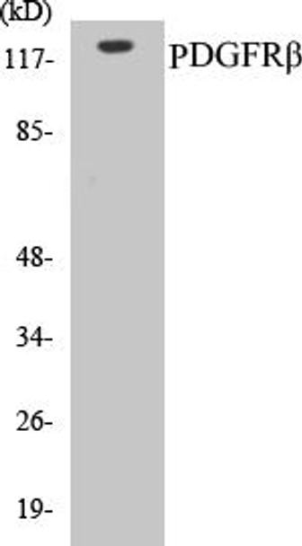 PDGFRbeta Colorimetric Cell-Based ELISA Kit (CBCAB00191)