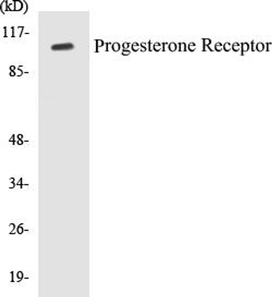 Progesterone Receptor Colorimetric Cell-Based ELISA Kit (CBCAB00195)
