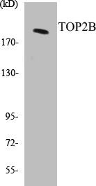 TOP2B Colorimetric Cell-Based ELISA Kit (CBCAB00202)