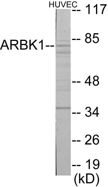 ARBK1 Colorimetric Cell-Based ELISA (CBCAB00211)