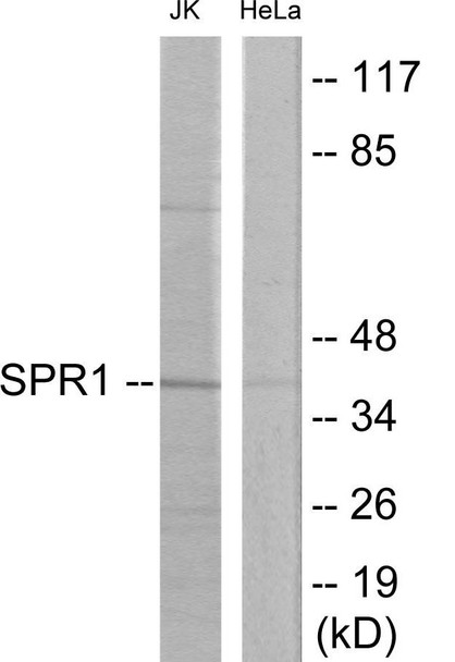 OGR-1 Colorimetric Cell-Based ELISA (CBCAB00216) OGR-1 Colorimetric Cell-Based ELISA (CBCAB00216)