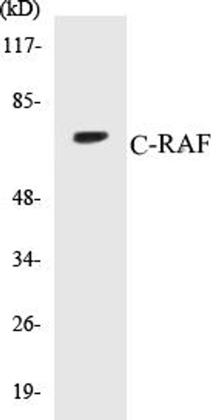 C-RAF Colorimetric Cell-Based ELISA Kit (CBCAB00289)