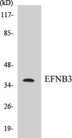 EFNB3 Colorimetric Cell-Based ELISA Kit (CBCAB00296)
