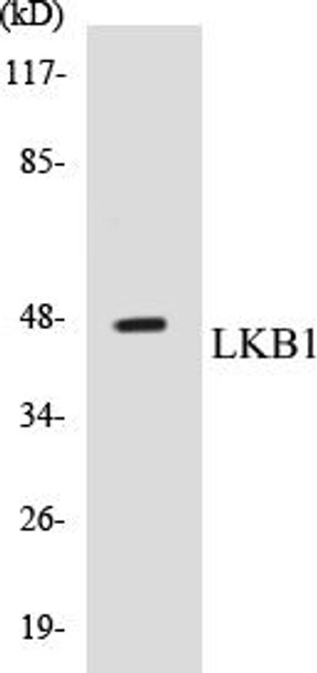 LKB1 Colorimetric Cell-Based ELISA Kit (CBCAB00323)
