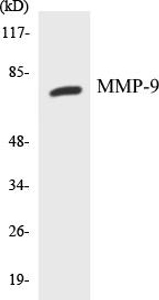 MMP-9 Colorimetric Cell-Based ELISA Kit (CBCAB00332)