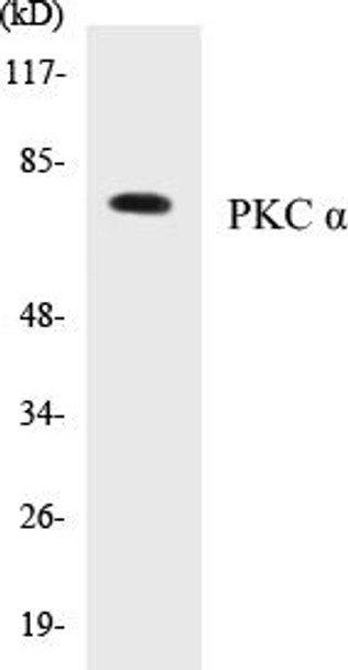 PKC alpha Colorimetric Cell-Based ELISA Kit (CBCAB00351)