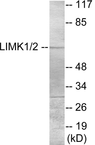 LIMK1 Colorimetric Cell-Based ELISA (CBCAB00382)
