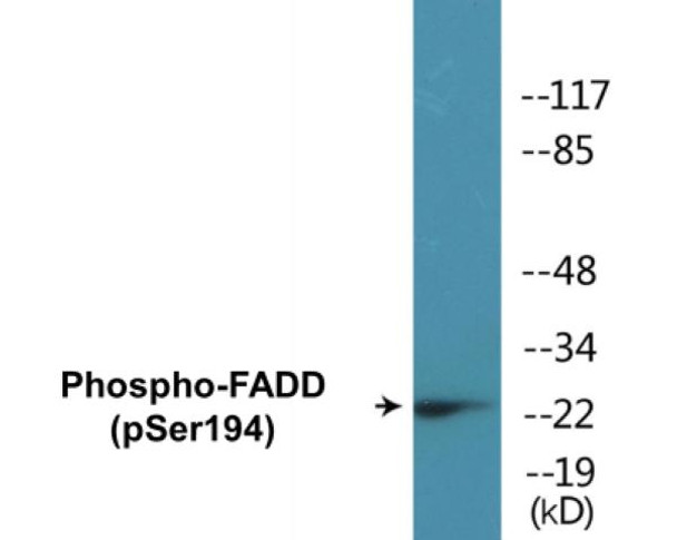FADD (Phospho-Ser194)Colorimetric Cell-Based ELISA Kit (CBCAB00410)