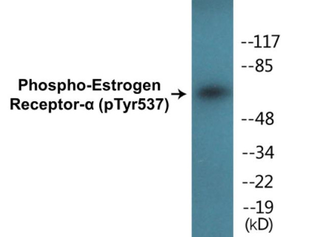 Estrogen Receptor-alpha (Phospho-Tyr537)Colorimetric Cell-Based ELISA Kit (CBCAB00415)
