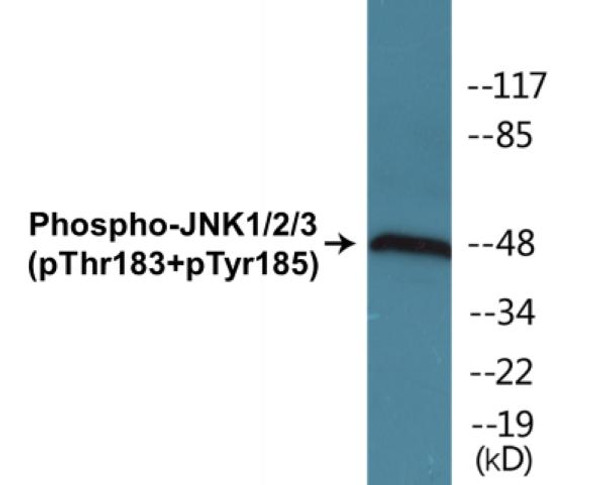 JNK1/2/3 (Phospho-Thr183+Tyr185)Colorimetric Cell-Based ELISA Kit (CBCAB00421)