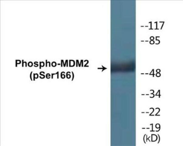MDM2 (Phospho-Ser166)Colorimetric Cell-Based ELISA Kit (CBCAB00423)