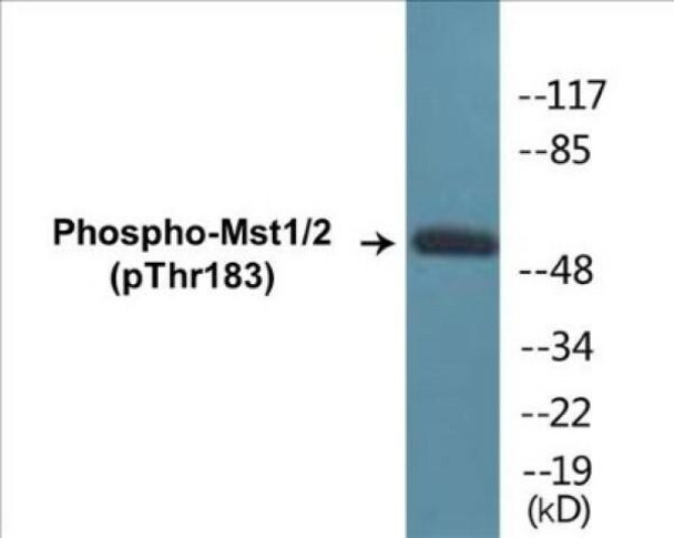 Mst1/2 (Phospho-Thr183)Colorimetric Cell-Based ELISA Kit (CBCAB00433)