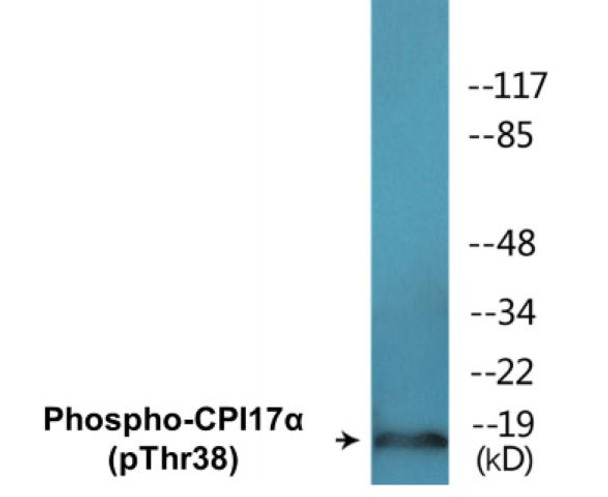 CPI17alpha (Phospho-Thr38)Colorimetric Cell-Based ELISA Kit (CBCAB00463)