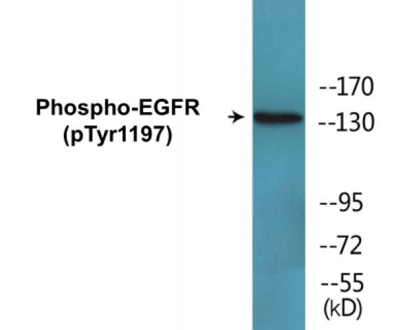 Phospho-EGFR (Tyr1197)In-Cell ELISA (CBCAB00464)