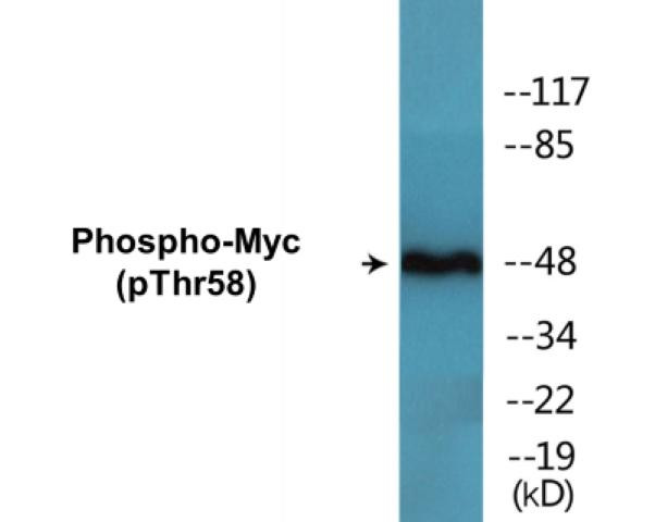 Myc (Phospho-Thr58)Colorimetric Cell-Based ELISA Kit (CBCAB00476)